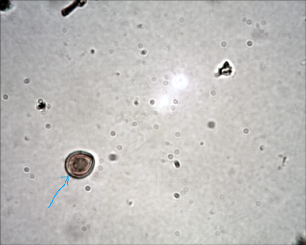 Perenniporia fraxinea (Bull)Ryvarden